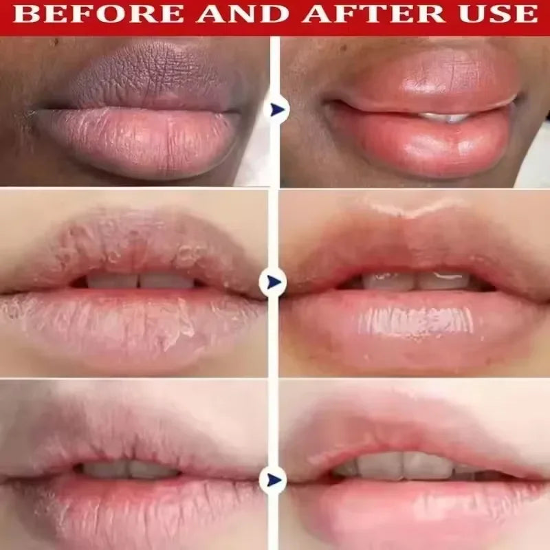 Fast Lighten Melanin Lip Mask