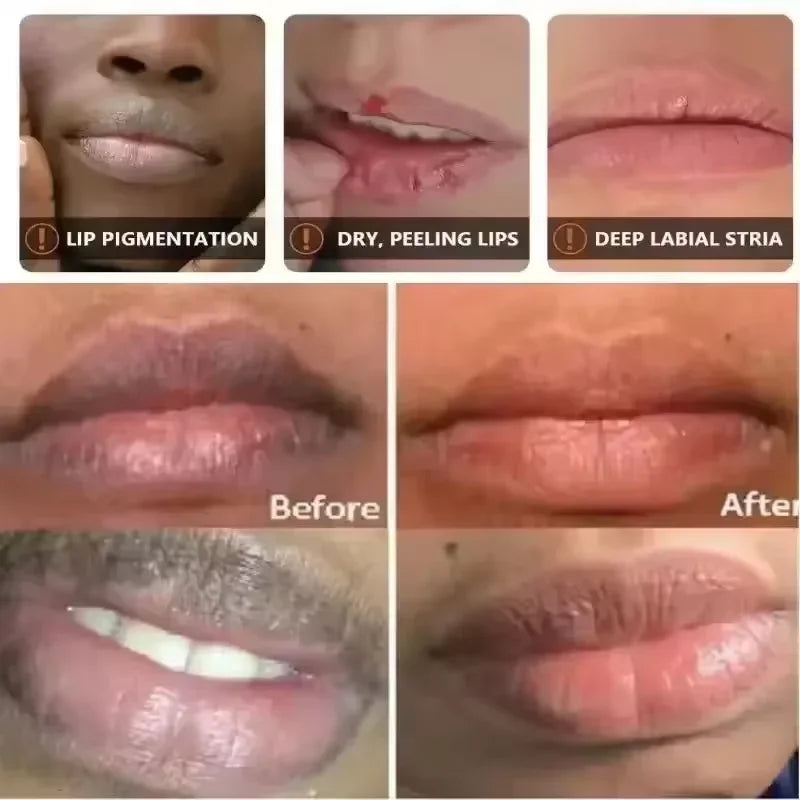 Fast Lighten Melanin Lip Mask